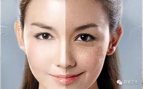 严重铅汞中毒斑多久能恢复,突然发现长斑了怎么回事