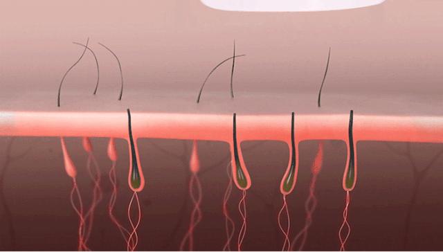 “闺蜜看见我脱毛,说我心机太重”