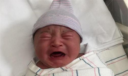 顺产转剖宫产,顺产转剖腹产后遗症