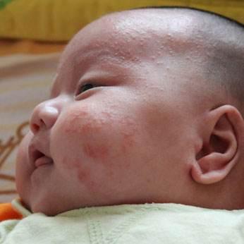 宝宝常见疾病预防及日常护理,宝宝常见疾病护理方法