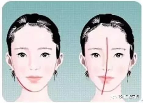 乳牙蛀牙清除真实全过程,小儿乳牙龋齿民间治疗偏方