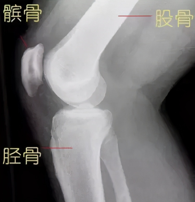 膝关节有时感觉很脆弱怎么回事,为什么膝关节容易受伤