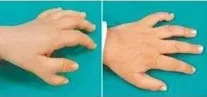 六指魔琴儿童,六指琴魔儿童版