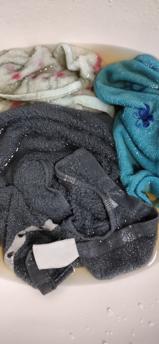 家里毛巾容易发黄怎么回事,毛巾挂着容易脏怎么办