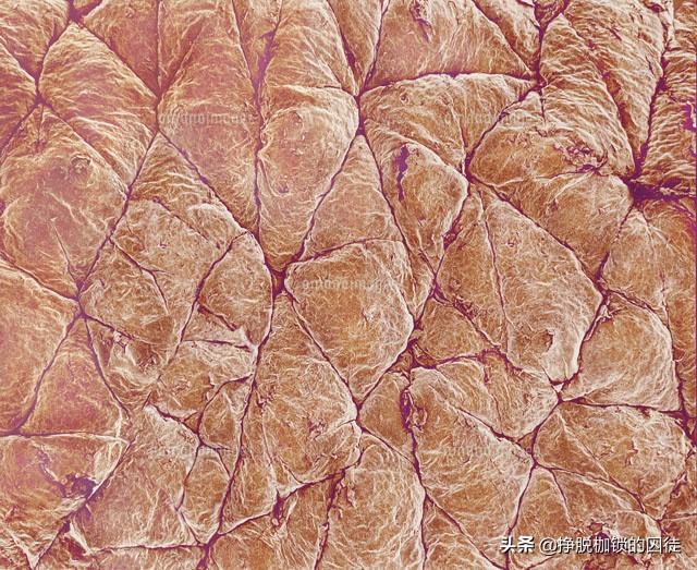 手心脚心容易出汗什么原因,手心为什么总是会出汗