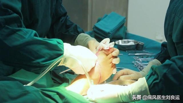 痛风20年长出痛风石，尝试“偏方”险中毒，尿酸高用药有讲究