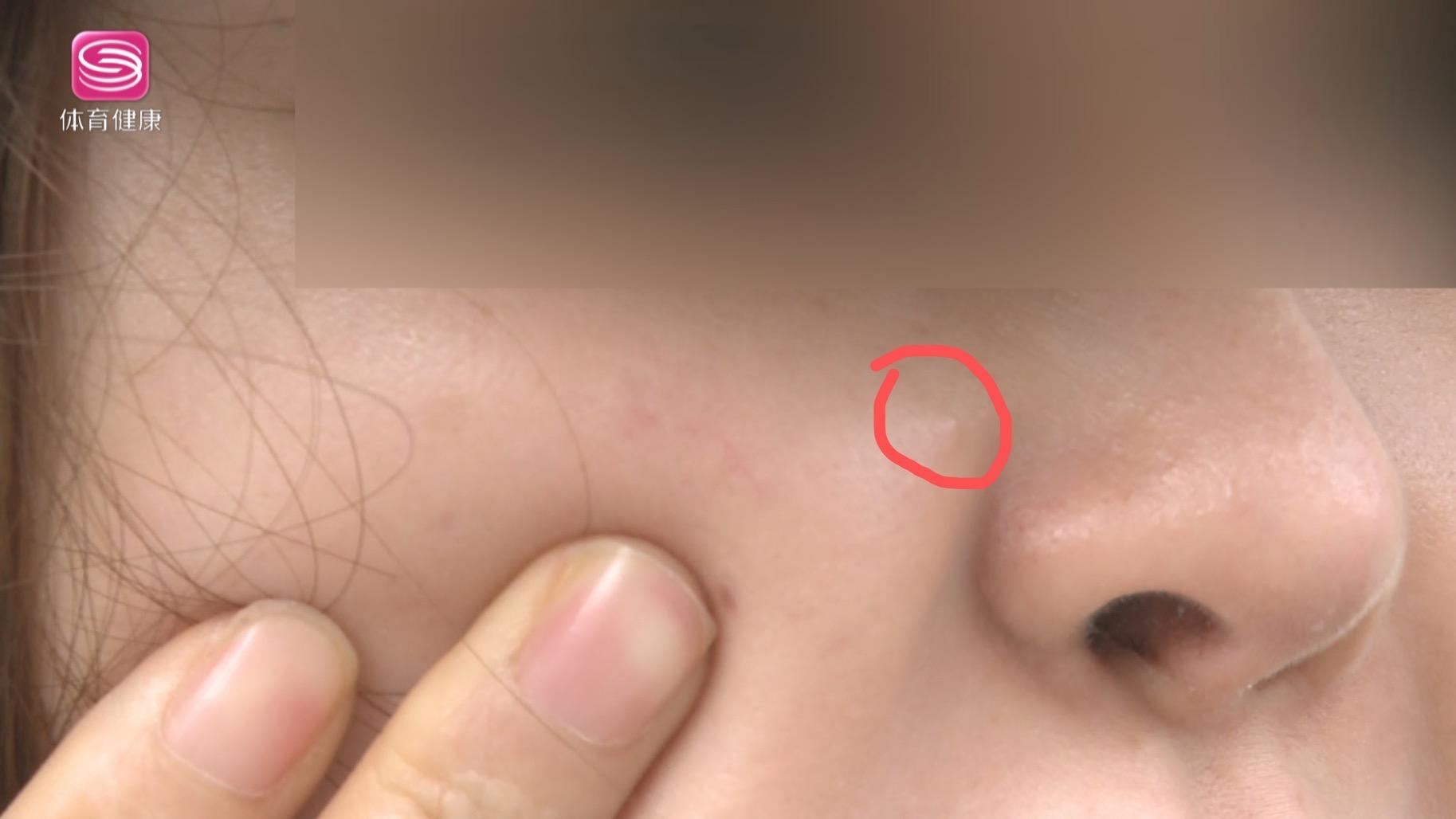 福华医疗美容医院正规吗,福华医疗美容医院怎样