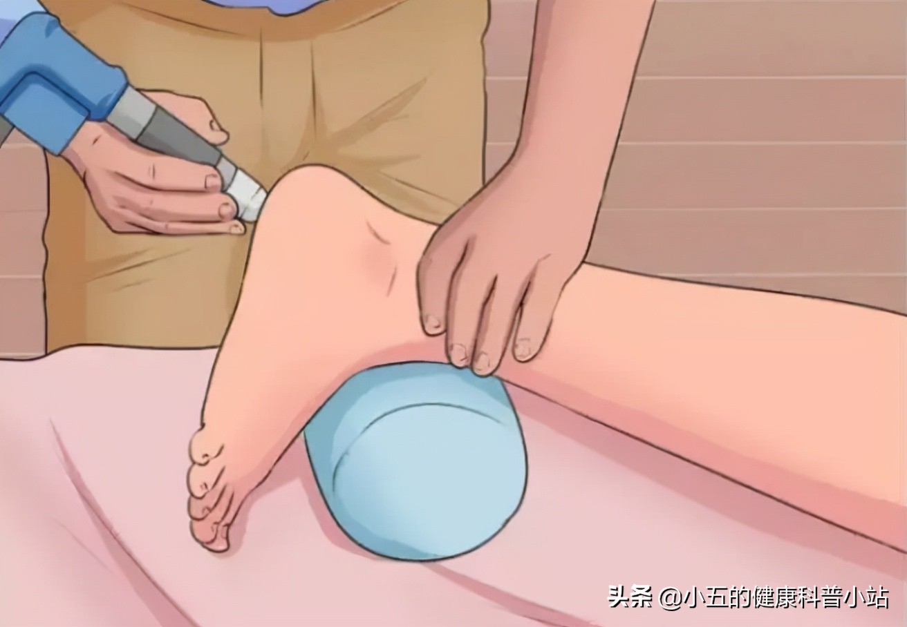 足跟痛疾病诊断与治疗要点,足跟痛跟哪些疾病有关