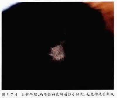 自我剖析问题原因和整改措施,自我诊断原因分析及改进措施