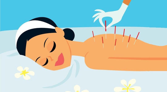 针灸减肥有没有什么副作用啊,关于针灸减肥有谁知道