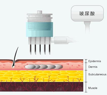 不花一分钱美白全身12岁,不花一分钱让皮肤紧致