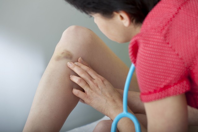 外伤留下的疤痕怎么消除,外伤后留下紫色凸起疤痕什么原因