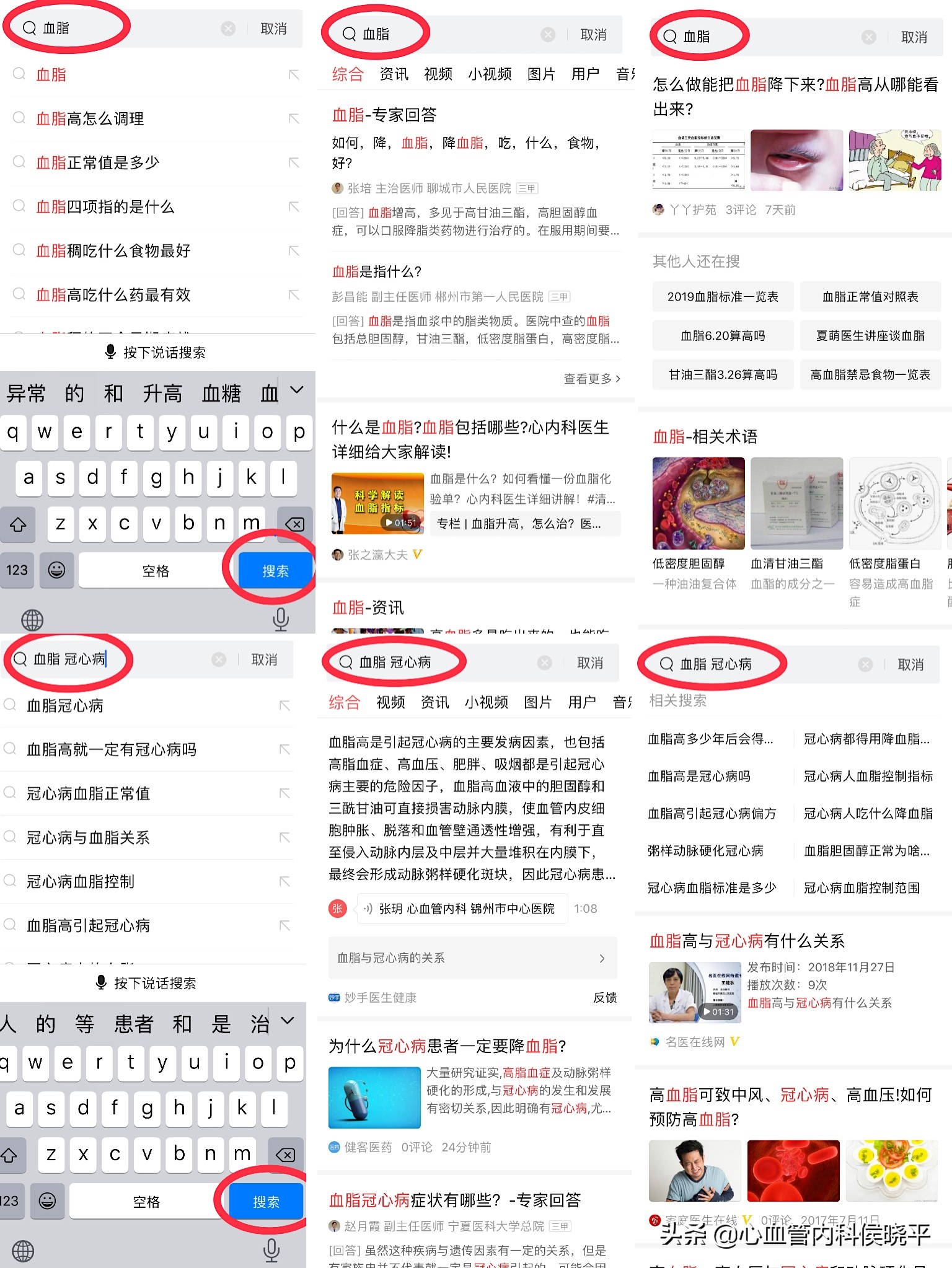 更年期血脂高怎么降下来,更年期血脂高身体有什么样的表现