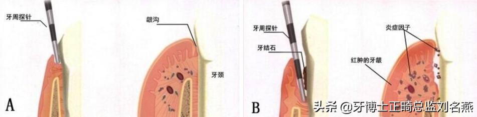 洗个牙1000块,洗个牙被人家骗几千块