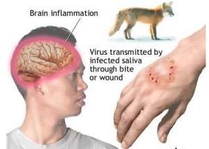 古代硬核的狂犬病治疗方式：烙铁直接烫伤口！这样的方法有用吗？
