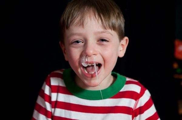 宝宝流鼻涕了不吃药有什么方法,宝宝流鼻涕不通气吃什么药管用