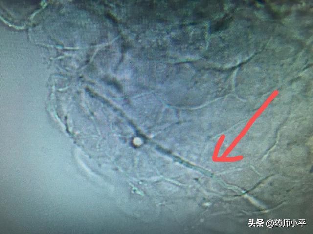 袜子和内裤一起会感染股癣吗,裤头和袜子一起洗了怎么办