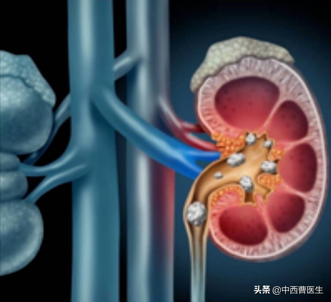 痛风的临床表现及健康教育ppt,痛风的诊断与治疗的内容