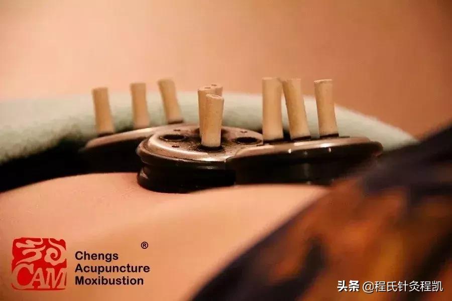 关于艾灸的那些事,答疑解惑揭秘