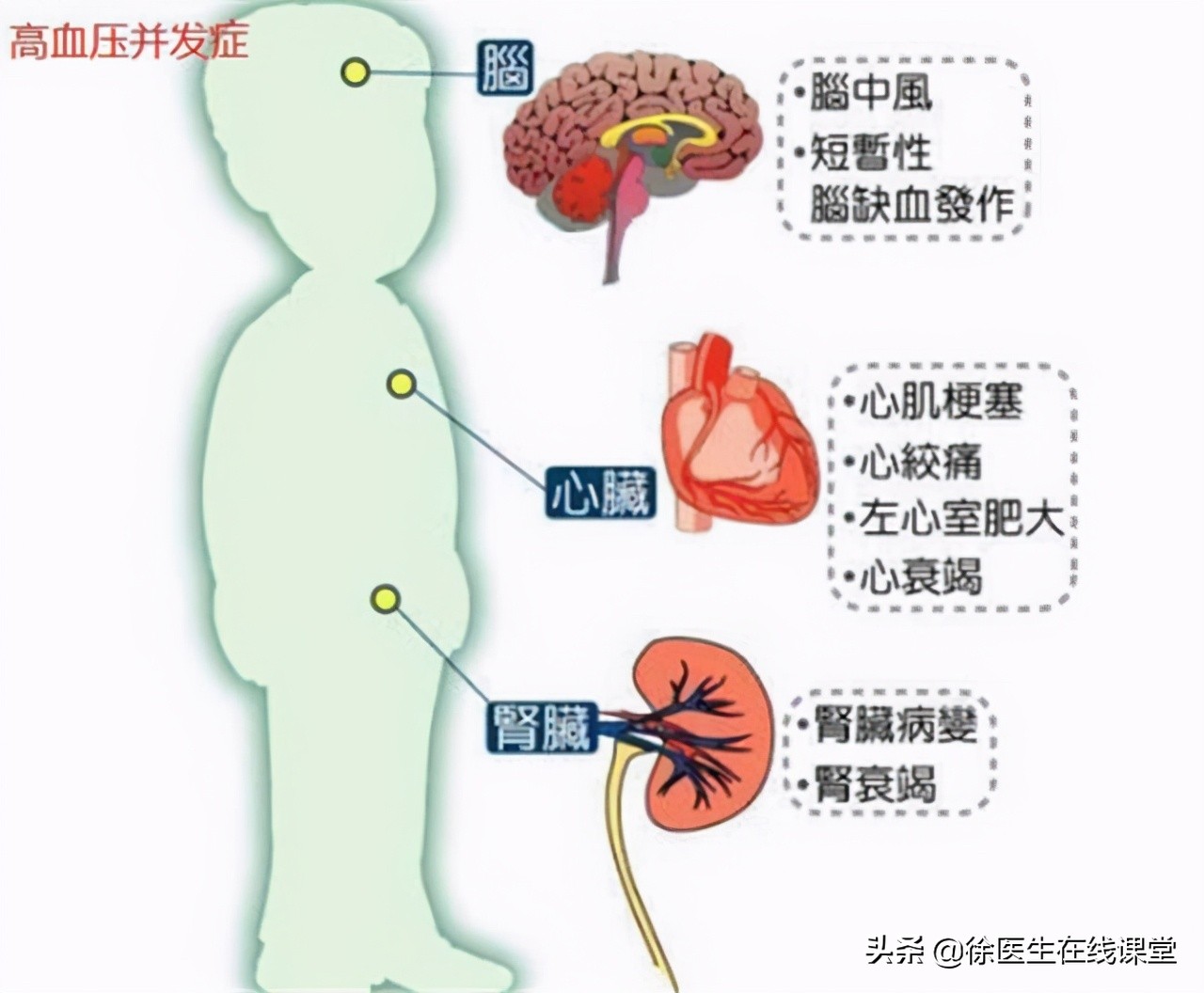 又一患者擅自服用阿司匹林导致胃出血！掌握2点，降低出血风险