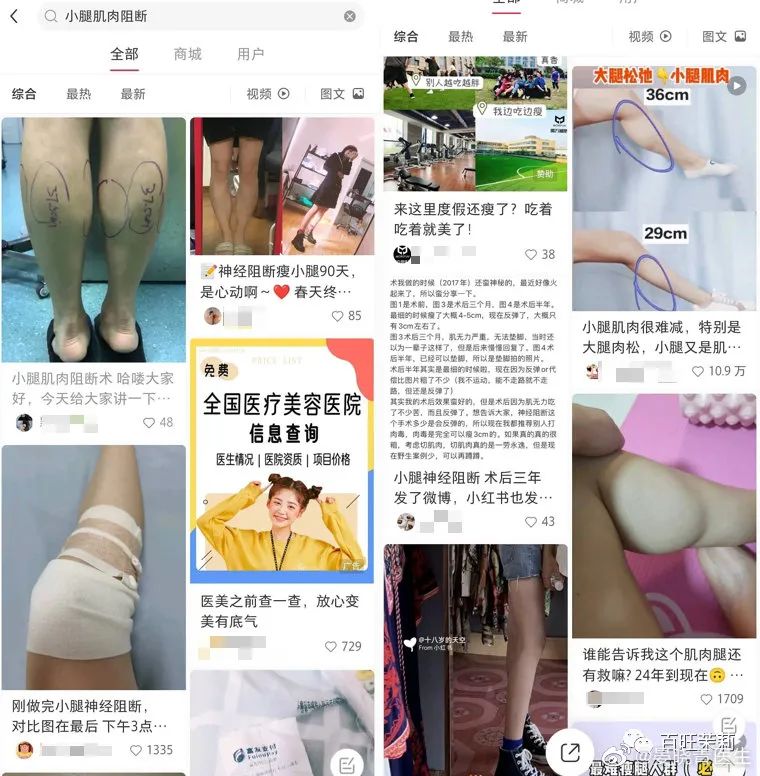 挑筋断骨切胃，那些为了美不要命的女人到底有多可怕