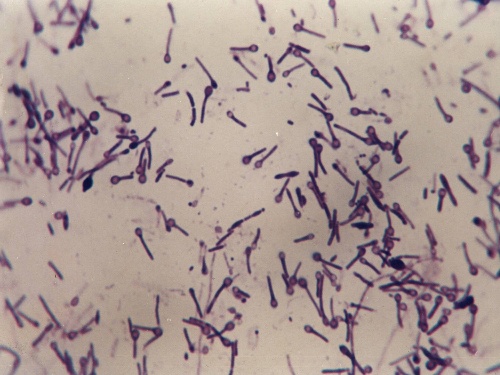 破伤风是用类毒素预防吗,破伤风类毒素和抗毒素的区别