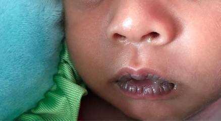 世界上最漂亮的嘴唇,世界嘴唇最厚的女人