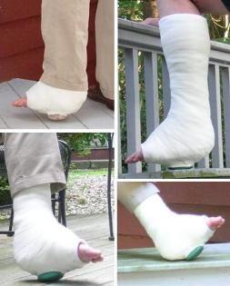 高处跌落脊椎骨折需要手术吗,高处坠落导致骨盆骨折怎样治疗