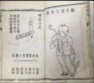 在没疫苗的古代,古代人是这样消灭天花的