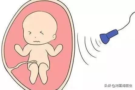 怀孕初期医生却让我做阴超，会伤害到肚子里的宝宝吗？