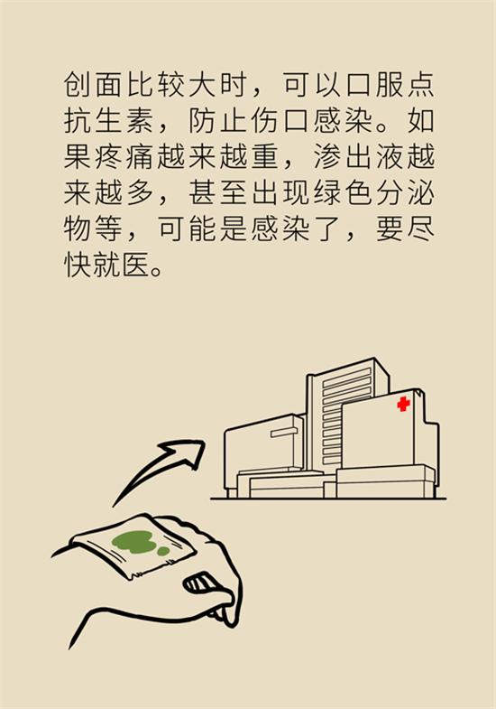 烫伤水泡如何换药,深2度烫伤换药总是有大水泡