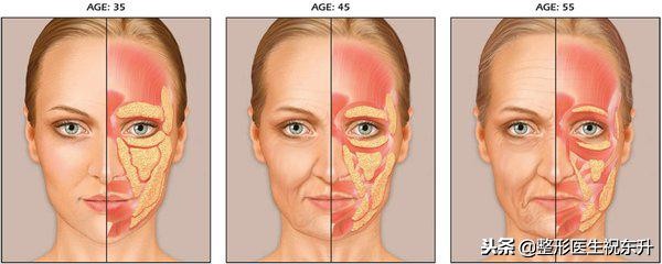 为什么我做了线雕没什么效果,为什么做了线雕没效果