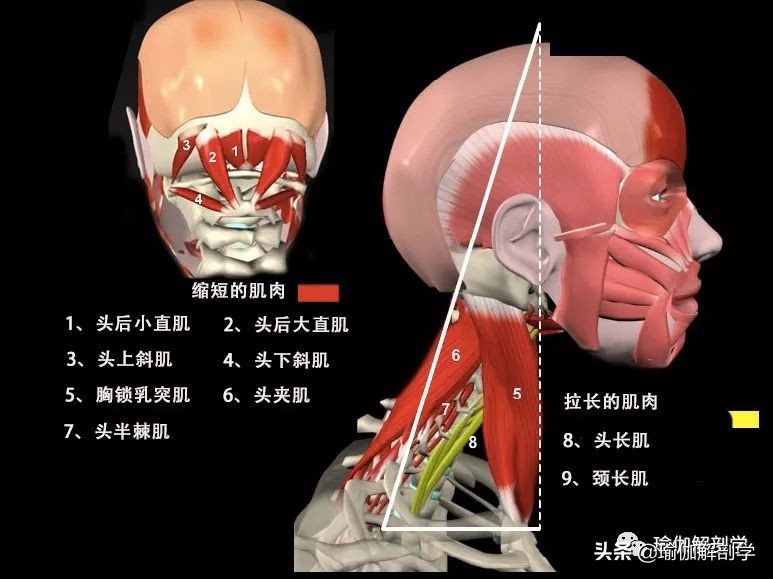 头前引怎么练体态,练瑜伽后显老怎么办