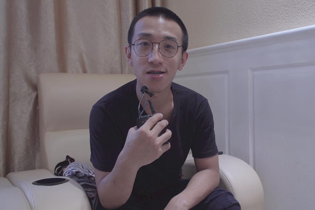 严重骨性地包天正畸效果,地包天矫正后又反颌怎么办