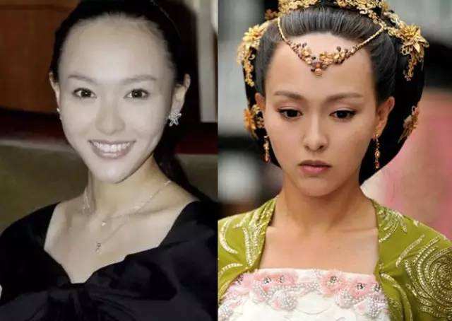 陈奕迅秃顶头发稀疏,陈奕迅同款发际线怎么补救