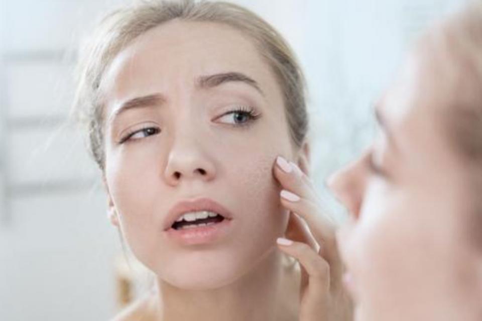 孕期脸上长斑的原因与调理,孕期脸上斑越来越多原因