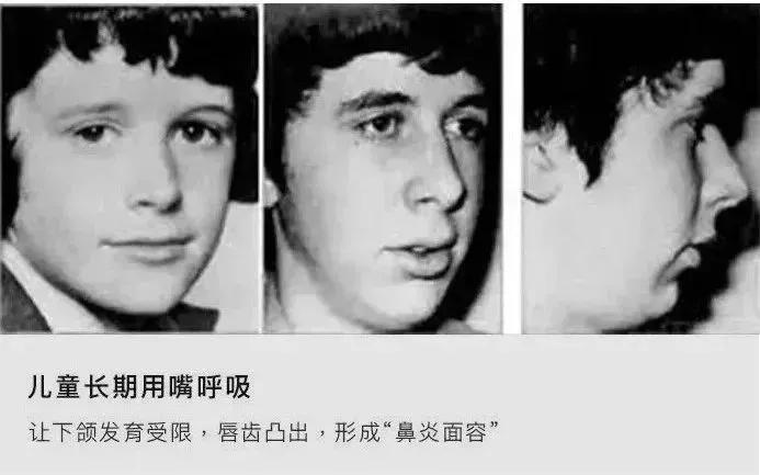 空调房鼻子痒打喷嚏怎么回事,夏季吹空调鼻子痒的原因