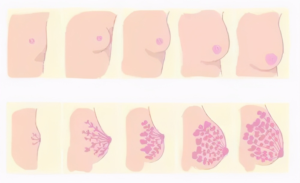 乳房几岁发育算晚,乳房几岁会下垂