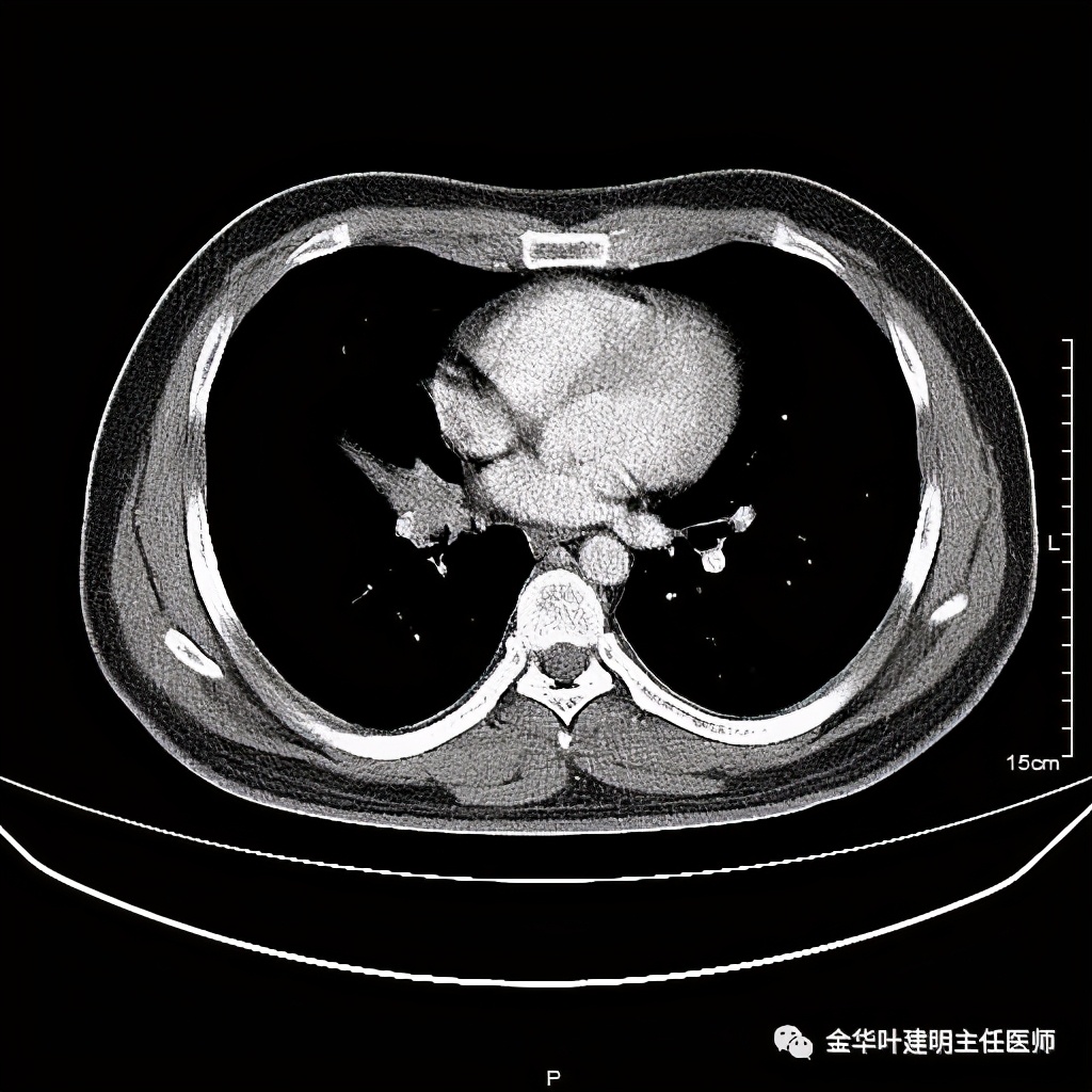 放个大招完整版教学,放个大招完整版前奏
