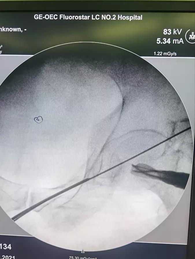 摘取皇冠,聊城市人民医院骨外科