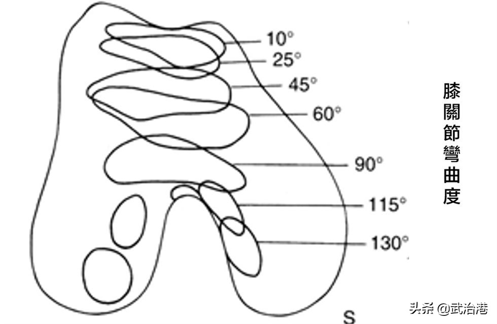 深蹲会伤膝盖吗,深蹲伤膝盖的原因
