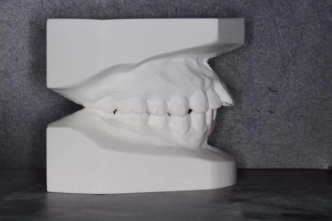 正规的北京牙齿矫正方案,牙齿矫正北京口腔医院