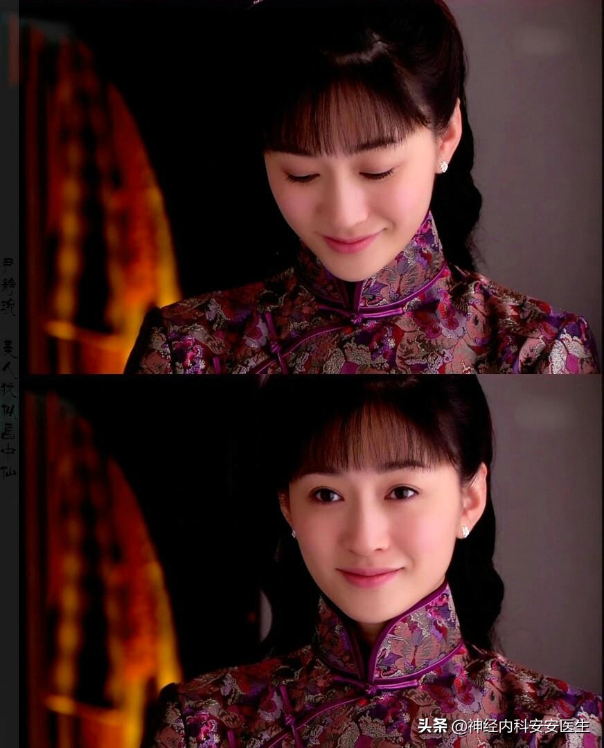 体重一下子减轻了十几斤,这是怎么了?是好还是不好呢?