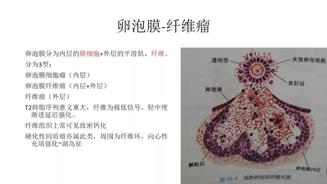 卵巢原发肿瘤的分析思路