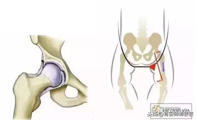 把尿真的有危害吗,把尿到底对婴儿好不好