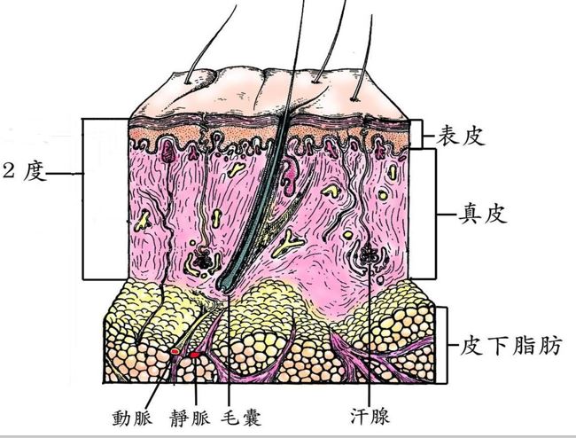 孩子烫伤记住5个字,牢记五字口诀轻松处理宝宝烫伤
