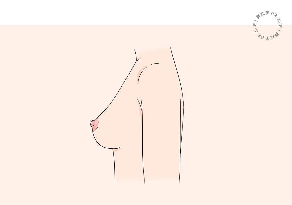 把胸往上提能治下垂吗,瑜伽可以使下垂的胸部上提吗