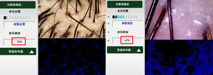 比较好用的德国防脱发,德国十大最好用的护肤品