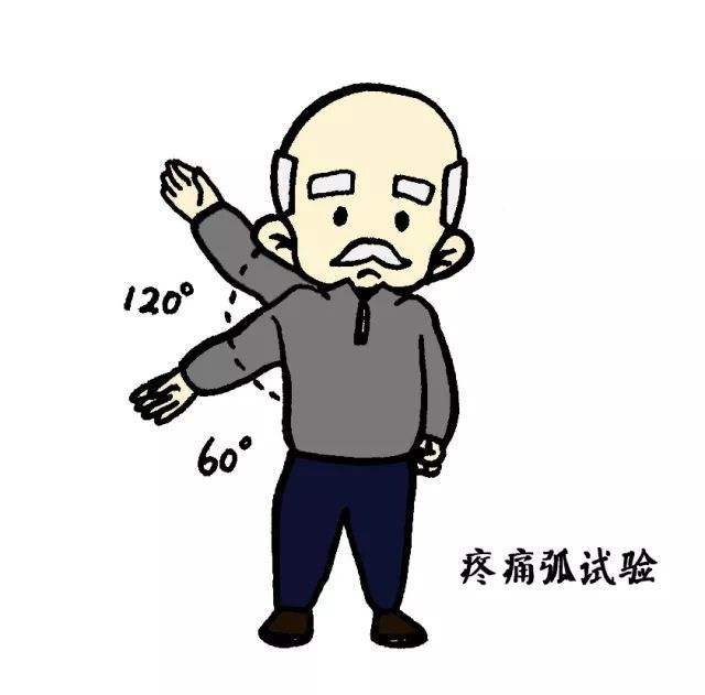 肩袖损伤不完全撕裂严重不严重,肩袖损伤不治疗得好吗