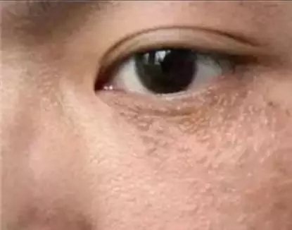 眼霜换着用会影响效果吗,眼霜涂了为什么还长细纹